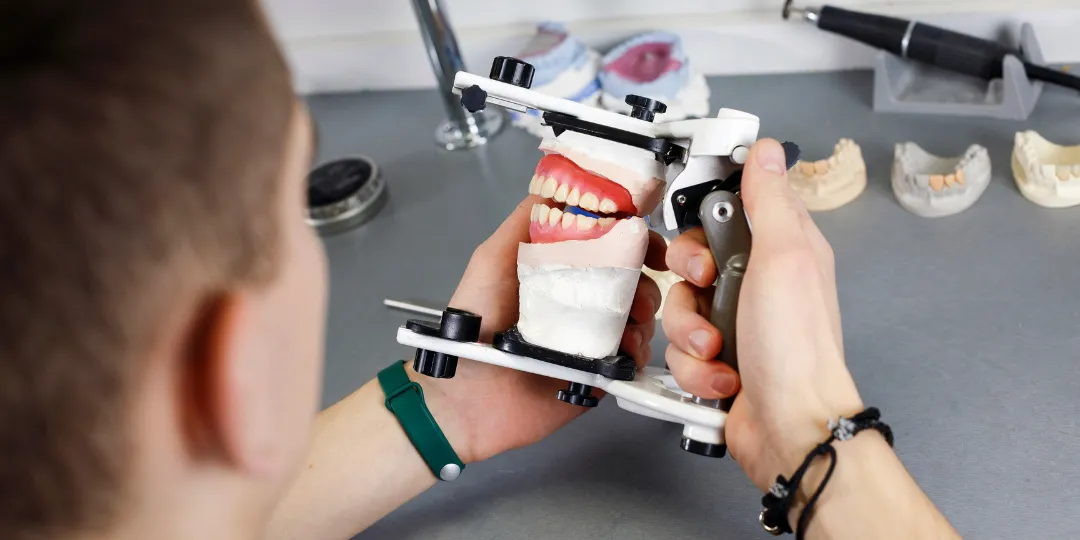 Cómo se construye una prótesis dental sin ganchos Valaplast Clínica Dental para ponerme una prótesis dental sin ganchos en Alcorcón
