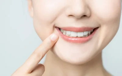 ¿Qué es una limpieza dental y por qué es importante?