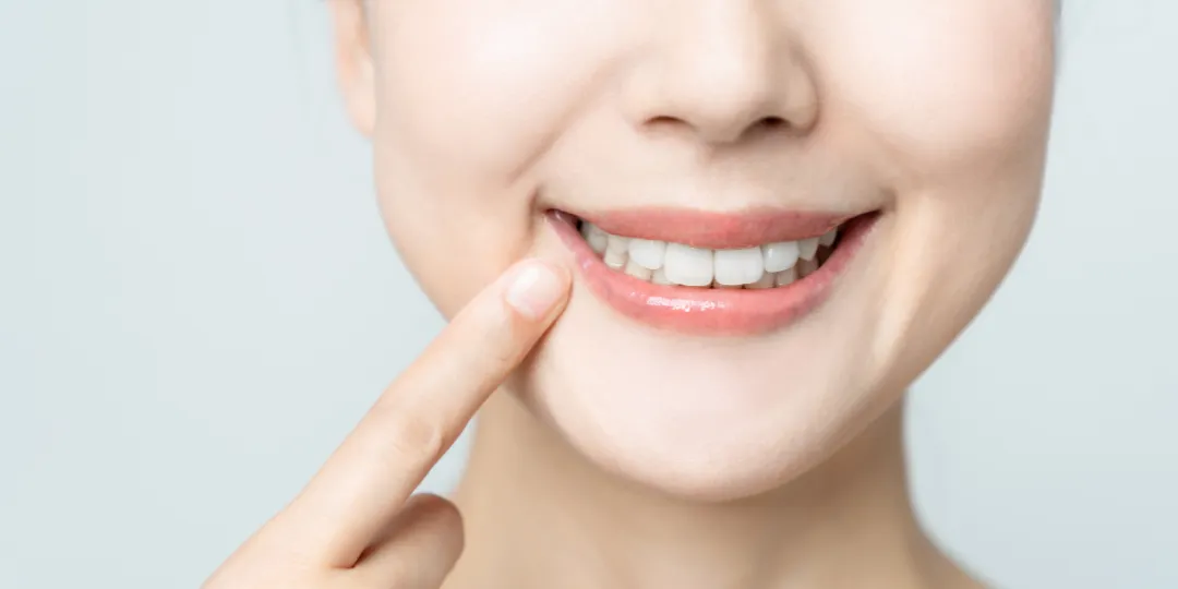 Limpieza de dientes Alcorcón